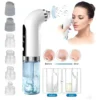 D_NQ_NP_825752-CBT90021292598_082025-O Extractor de Espinillas Vapor Hidrodermoabrasión