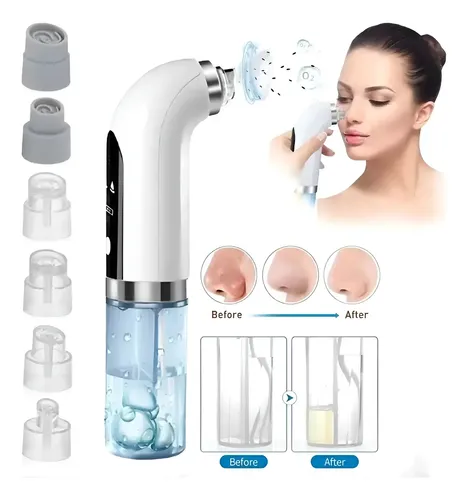 D_NQ_NP_825752-CBT90021292598_082025-O Extractor de Espinillas Vapor Hidrodermoabrasión